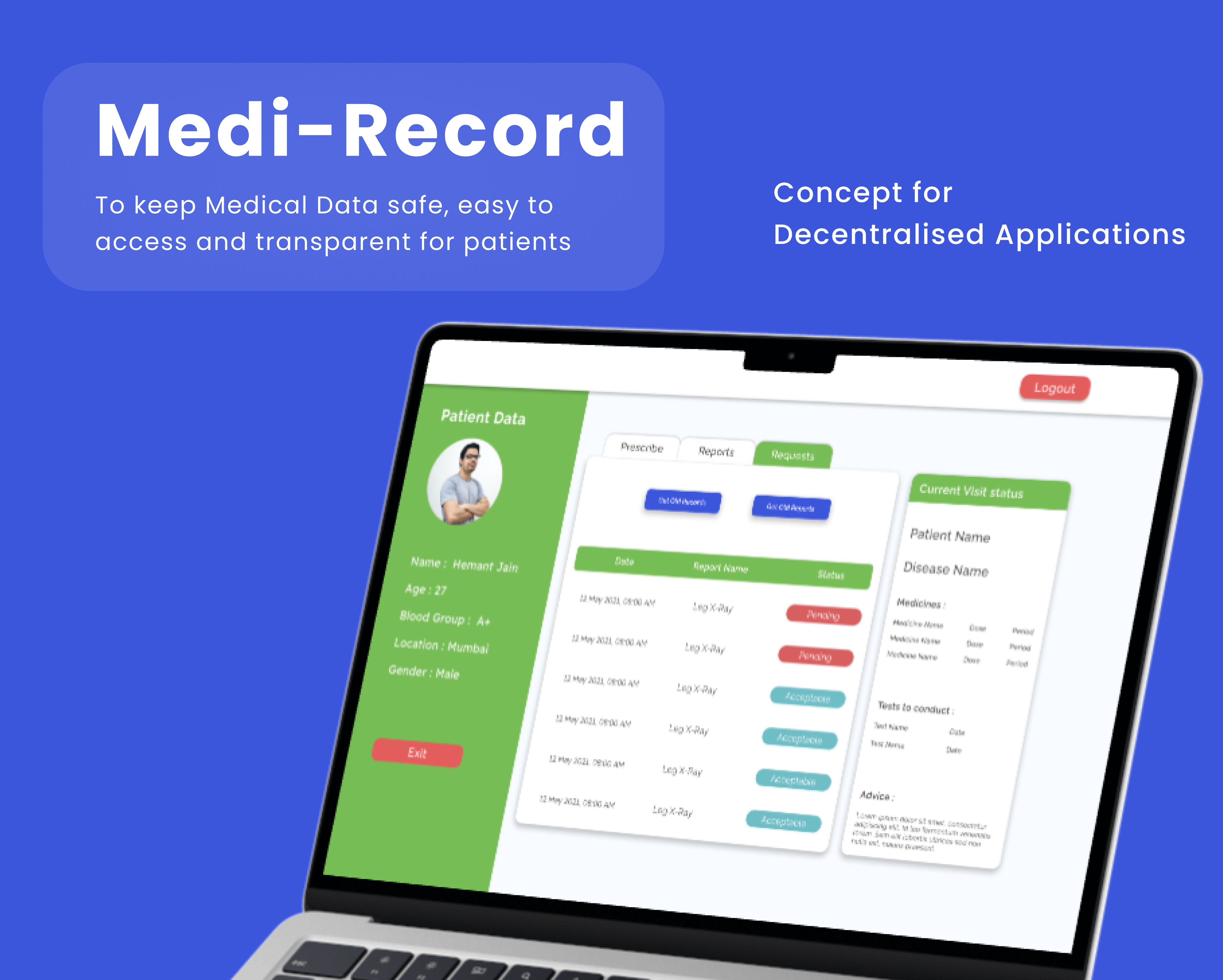 Metaphor is Beautiful